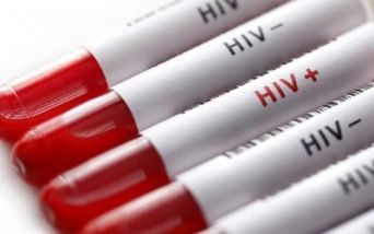 AIDS