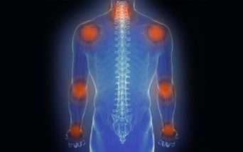 Artrite psoriasica