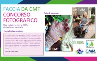 Faccia da CMT