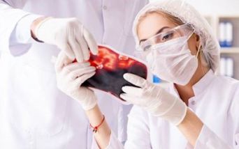 Raccolta di plasma