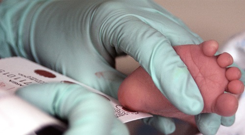Bambino sottoposto a screening neonatale