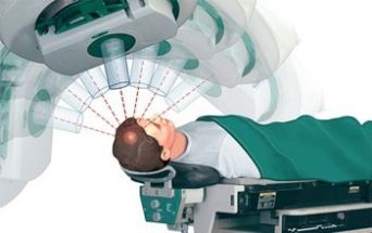 Radioterapia