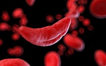 Anemia falciforme: presentato il romanzo “Sangue a falce”