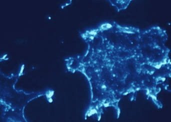 Cellule tumorali
