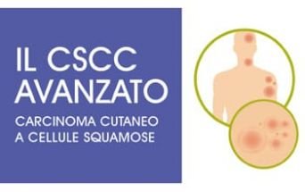 Carcinoma cutaneo a cellule squamose