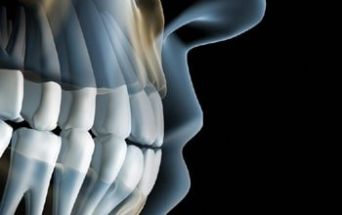 Denti