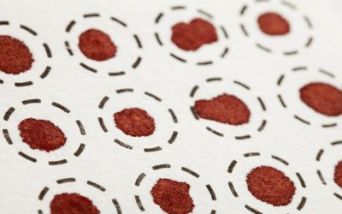 Dried Blood Spot