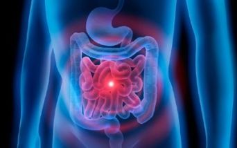Pseudomixoma: un tumore che cresce nell’addome