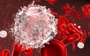 Leucemia linfoblastica acuta