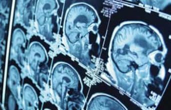 Neurologia