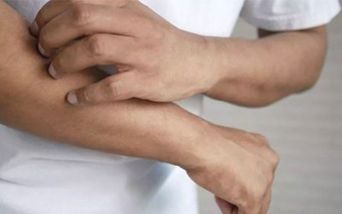Psoriasi, l'importanza di parlarne