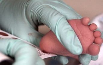 Screening neonatale SMA in Piemonte