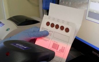 Deficit di sfingomielinasi acida e screening neonatale