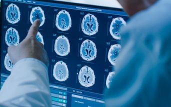 Neurologia