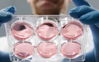 Prader-Willi, primi test su nuova terapia