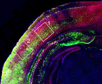 Sezione di corteccia cerebrale di topo – Per cortesia della SISSA di Trieste