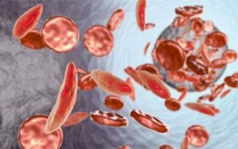 Editing genomico per Beta talassemia e anemia falciforme, EMA valuterà immissione in commercio di nuovo farmaco