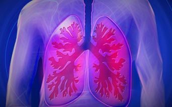 interrogazione Malattia polmonare da micobatteri non tubercolari