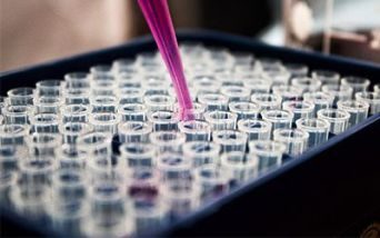 SLA: in Puglia una proposta di legge per la diagnosi