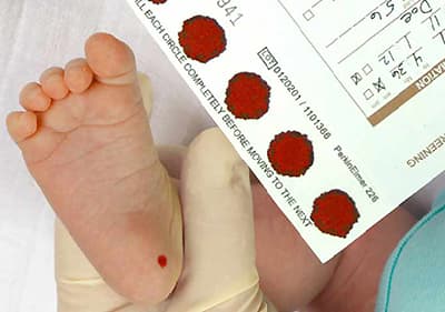 procedura di screening neonatale