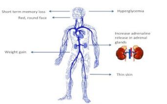 Sindrome di Cushing