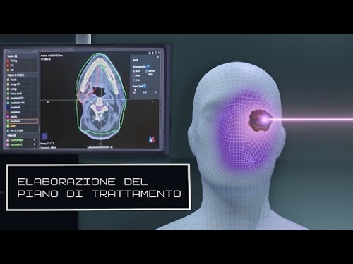 Visualizza